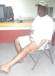 Released on bail: former inmate Roscio Mercurius displays his fractured leg and some of the bruises he sustained from beatings in the Georgetown Prison. 