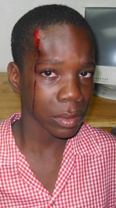 The injured Kester Howes