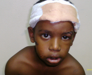 Boy, 4, mauled by dog – Kaieteur News