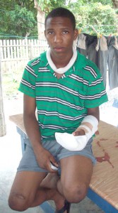 An injured  Shaquille DaSilva