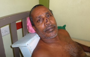 Injured RK security guard, Razack Mohamed Juman at GPHC yesterday