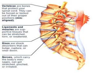 back pain copy 2