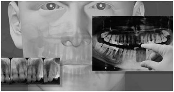 dental x-ray copy