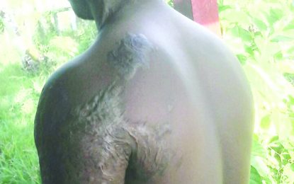 Man gets 11 years for dousing school boy with acid