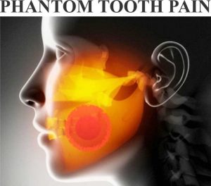 phantom-tooth-pain