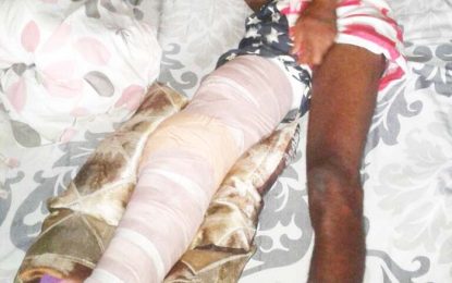 ‘Police knocks down motorcyclist, tries to escape –Guyhoc resident