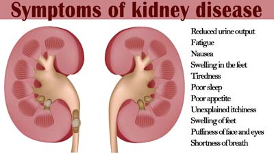 kidney-disease – Kaieteur News