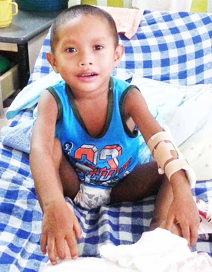 Boy, 3, survives bite from venomous snake – Kaieteur News