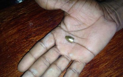 Man wakes up to find bullet lodged in TV stand