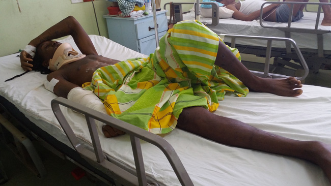 Young father still recovering from holiday accident - Kaieteur News