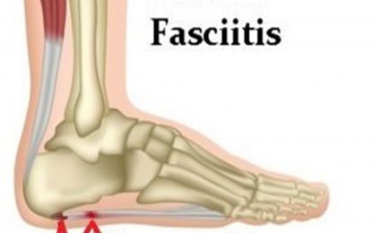 Heel Pains: Is it a spur or something else?