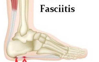 Heel Pains: Is it a spur or something else?