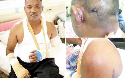 Police ranks injured in Berbice protests recovering