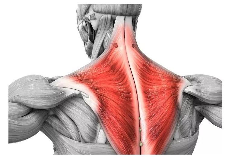 Cloud Nine Massage - Maplewood - Muscle Monday - Trapezius The most  superficial muscle in the upper back and one of the most common muscles  that people experience pain and tension in.