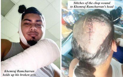 Essequibo Pump attendant seeks for justice after being attacked by irate customer, accomplice