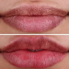 How To Get Rid of Chapped Lips