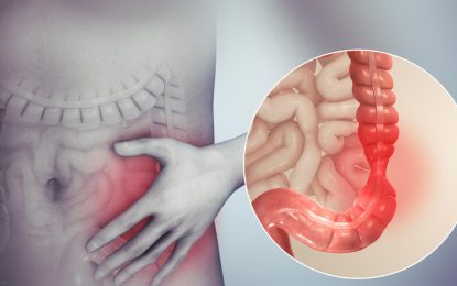 Irritable Bowel Syndrome (IBS): It may be the cause of your discomfort