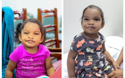 Two hinterland children benefit from corrective cleft surgery through Food for the Poor program