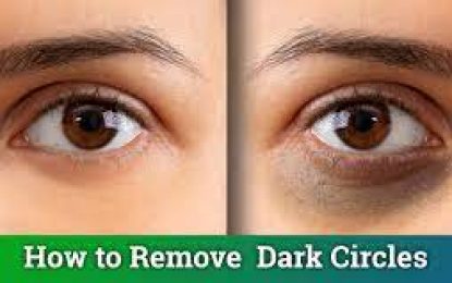 Ways to help remove dark circles under eyes permanently