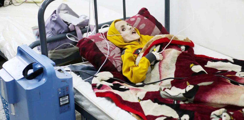 Yazan Kafarneh on his hospital bed in Rafah, southern Gaza, on Sunday. By Monday, he was dead. Credit...Hatem Ali/Associated Press