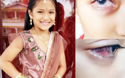 Young cancer survivor needs financial help to save her sight