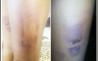 Man beats partner with paddle, chokes mother-in-law