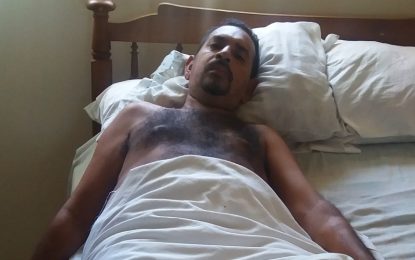 Five-time Chutney King hospitalised