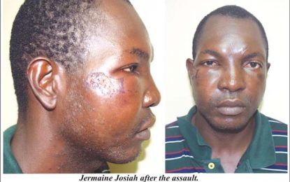 Accused of arson, fire victim allegedly detained, assaulted by off duty cop