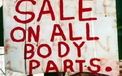 That thriving organ ‘black market’