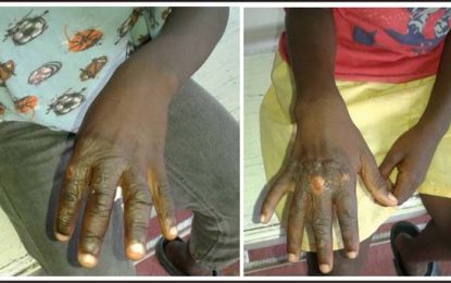 Father abuses children over missing Milo, milk and $100