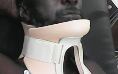 Man’s sight affected after beating