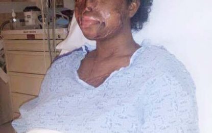 Acid attack victim likely to regain sight