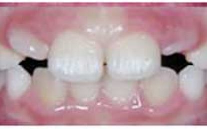 THE UGLY DUCKLING STAGE