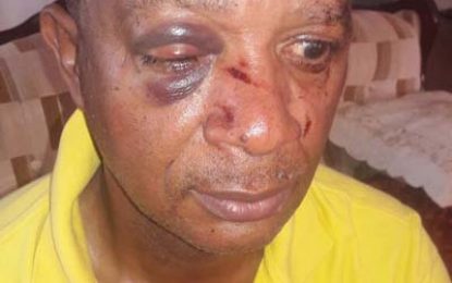 Sports executive beaten, robbed during home invasion