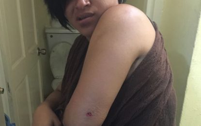 Six armed robbery charges for bandit who shot ex-cop’s daughter and colleague