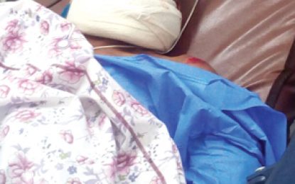 19 days after struck by car, cyclist still unconscious