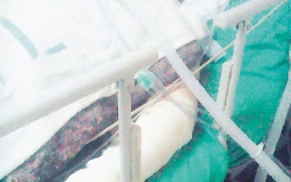 Man confesses to burning  wife with kerosene stove