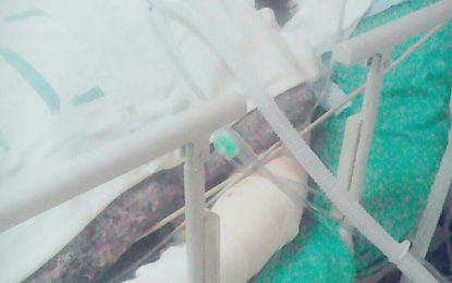 Woman succumbs to burns allegedly inflicted by husband