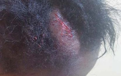 OPR completes probe of reported beating of ‘child mother’ by policewomen