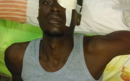 Youth on $100,000 bail for bottle-throwing incident that cost man his left eye