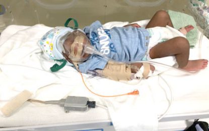 No shortage of oxygen at New Amsterdam Hospital – Ministry assures