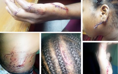 Woman goes into hiding after police fail to capture attacker