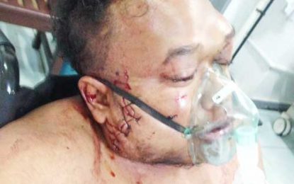 Brothers detained for assault, shooting outside Palm Court