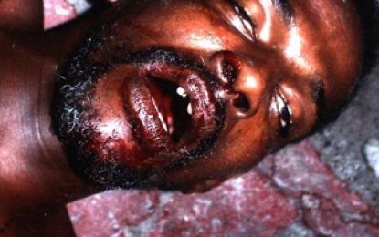 ‘Nick-Knock’ being hunted for ‘Overdose’ killing on Hadfield Street