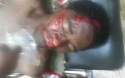 Police seeking help to identify man who died in Berbice accident