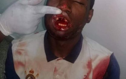 Three ranks under close arrest, cops still to question injured Rasville youth