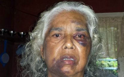 One arrested for burnt remains of West Berbice granny-she was beaten, robbed two years ago