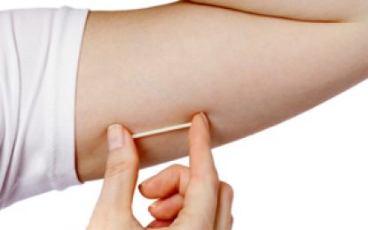 Implant Contraceptives Available Nationwide- Dr. Umadai Rattan–New in arm implant preferable by women