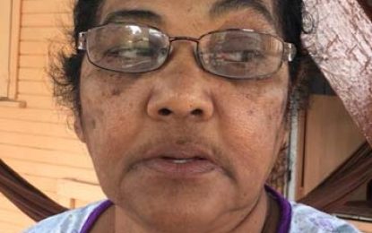 Bloomfield woman, 63, pushed off shed during home invasion