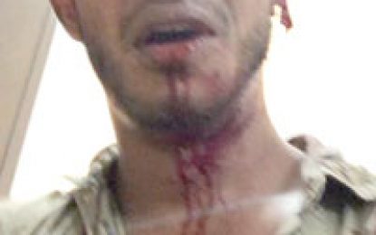 Youth charged for robbing race car driver, others